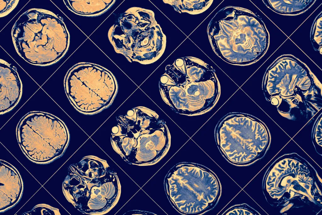 Neurourología
