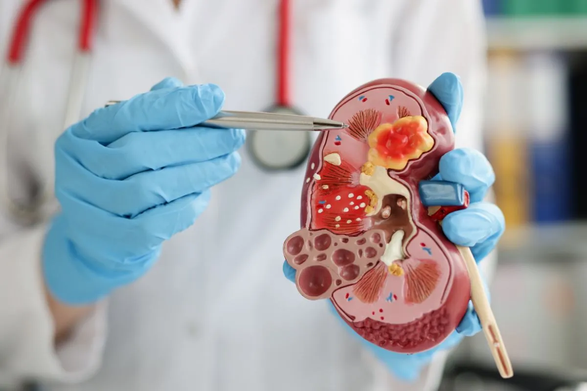 Quiste renal (destechamiento)