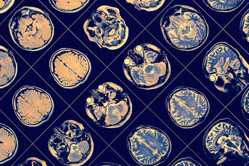 Neurourología