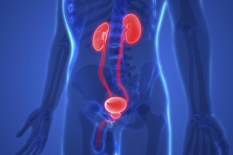Urología General